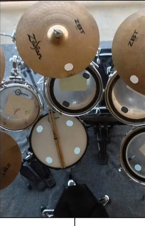 Millenium_Gel_Damper_Pads_6pcs_ Atténuateurs d'harmoniques pour Batterie